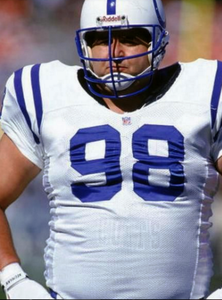 Tony Siragusa Cause of Death, Obesity, and Heart Attacks