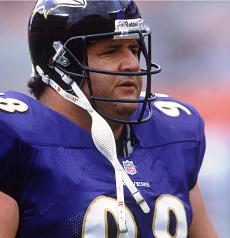 Tony Siragusa Cause of Death, Obesity, and Heart Attacks