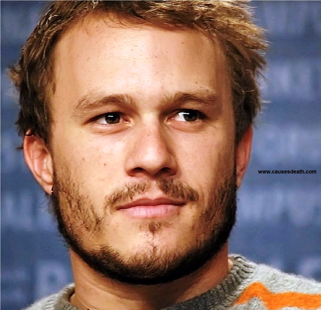 Heath Ledger Cause Of Death Revealed 