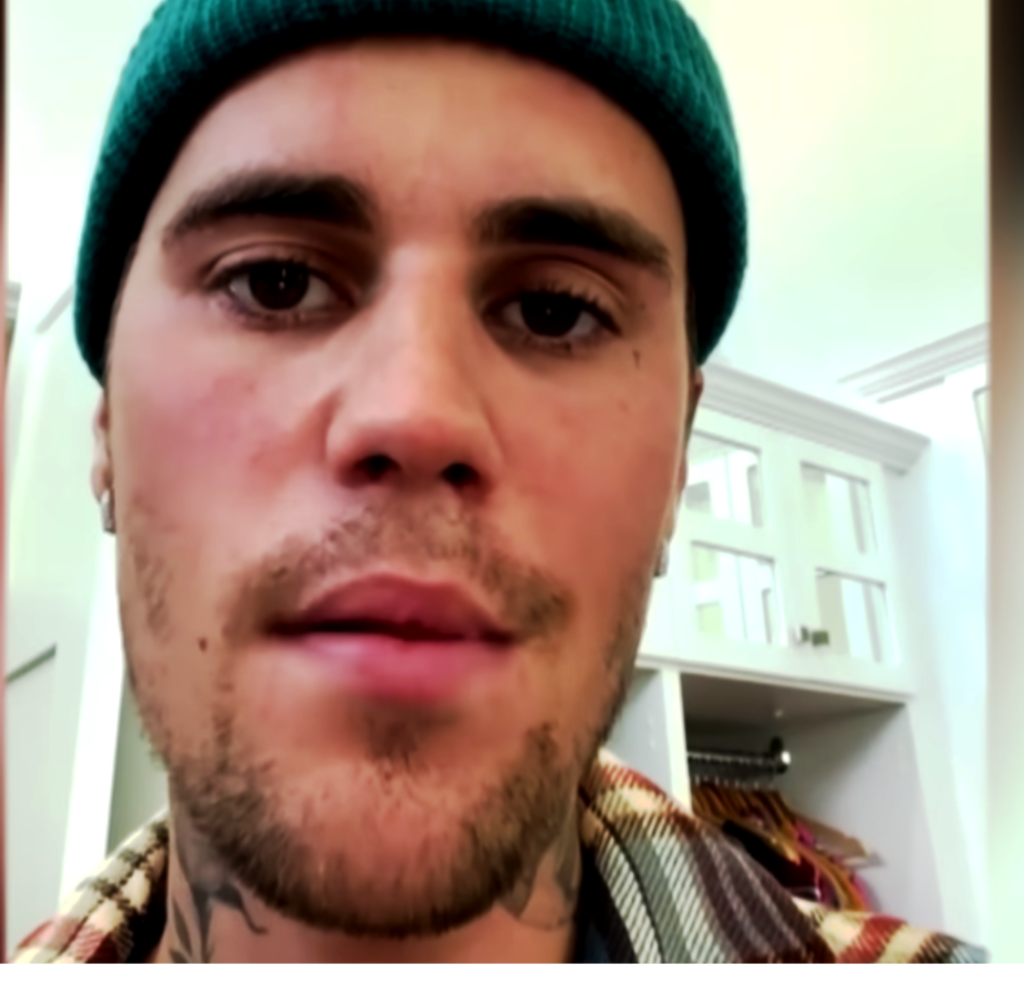 Justin Bieber Causes Of Death A Look Back at His Impactful Journey