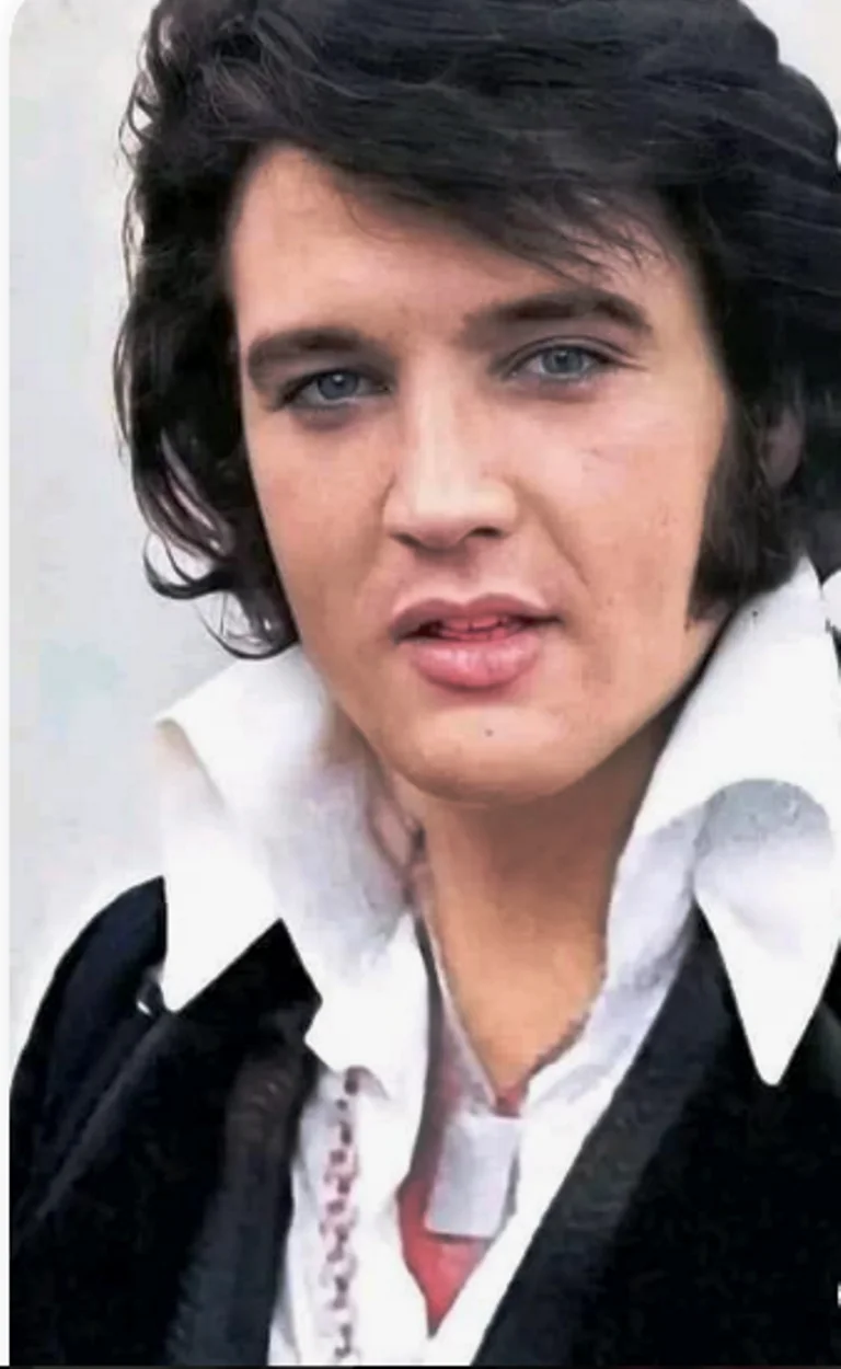 Elvis Presley Cause Of Death