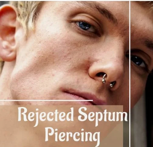 Septum Piercing: Detailed Information